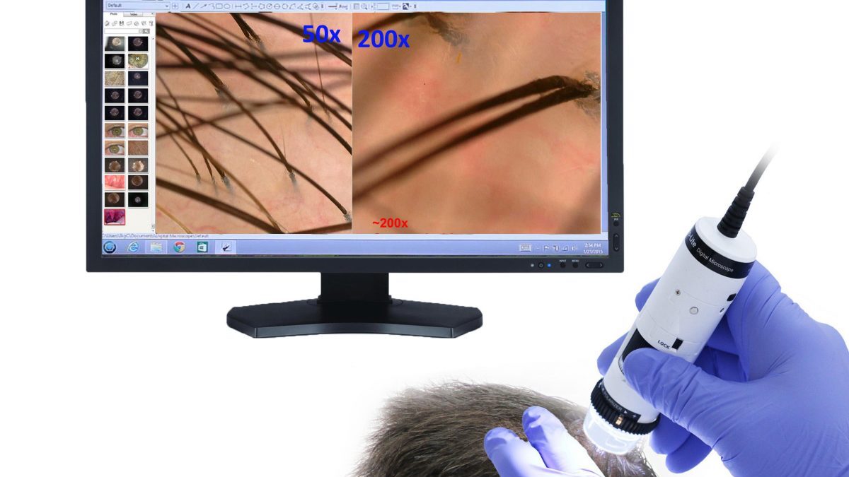 Diagnostic tricoscopie digitala