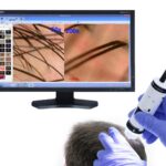 Diagnostic tricoscopie digitala